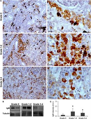 Dysregulation of B Cell Activity During Proliferative Kidney Disease in Rainbow Trout